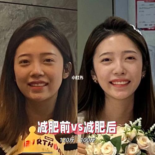 瘦了35斤的面部变化,瘦了35斤的面部变化图片