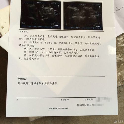 医生误做腹超被停工,医生误做腹超被停工怎么赔偿