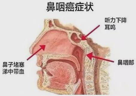 患瘤拒上夜班被开除,患瘤拒上夜班被开除有赔偿吗